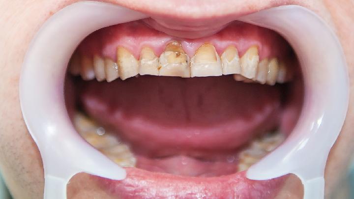 6種飲食減肥偏方原理 6種飲食減肥方法原理-易網健康養生網 6種飲食減肥偏方原理 6種飲食減肥方法原理