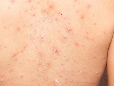 中年人飲食減肥要注意什么 中年人飲食減肥要注意哪些事項