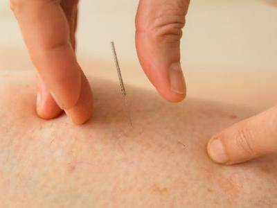 怎么運動減肥？運動減肥要遵循的3大定律