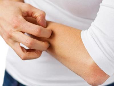 正確的喝水減肥法是什么？怎么喝水能減肥？