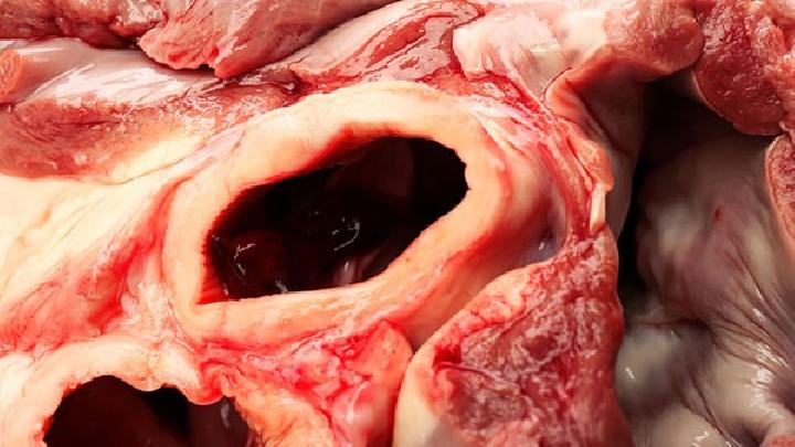 減肥能吃帶魚嗎？減肥期間吃帶魚需要注意什么？