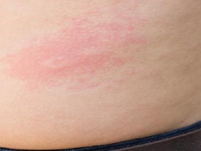 打籃球和跑步哪個(gè)減肥呢?減肥什么方法好？