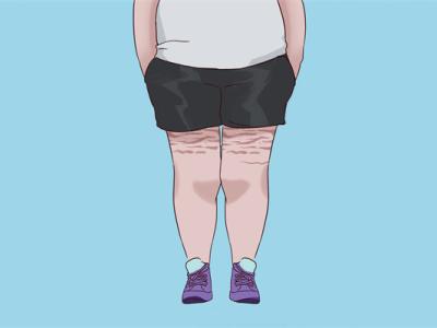 常見的減肥誤區(qū)都有哪些