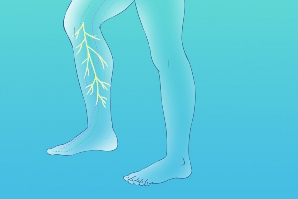 瘦小腿的方法有哪些