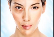 明星愛(ài)打的美白針 效果究竟怎么樣？