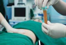 吸脂后皮膚“松了”怎么辦?