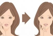 法令紋能去除嗎?去除法令紋的方法有哪些?