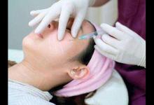 打玻尿酸要謹慎！或會留下這些后遺癥