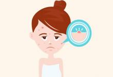 總爆痘！皮膚護(hù)理這些誤區(qū)要避免