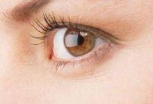 3大原因導致魚尾紋?3種醫美方式幫你去除