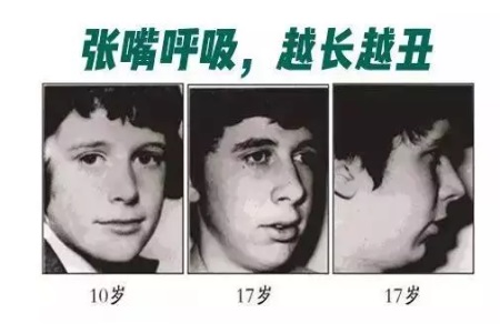 這些讓你變丑的習(xí)慣，再不改那可就沒救了！