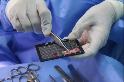 關于『 萌芽仿生綜合隆鼻術』你想知道的都在這里！