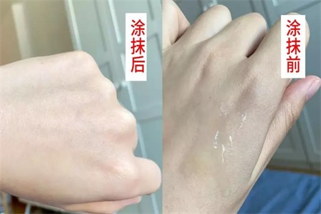 敏感肌膚用什么護膚品?推薦這款護膚禮盒清爽過夏天-易網健康養生網 敏感肌膚用什么護膚品?推薦這款護膚禮盒清爽過夏天