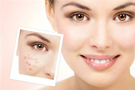 四大肌膚護(hù)理秘訣,生活護(hù)膚必備技能-易網(wǎng)健康<a href=http://www.jsjjzhkt.cn/jkys/ target=_blank class=infotextkey>養(yǎng)生</a>網(wǎng) 四大肌膚護(hù)理秘訣,生活護(hù)膚必備技能