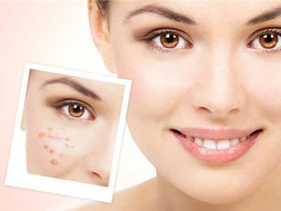 四大肌膚護理秘訣,生活護膚必備技能