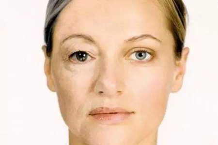 卸妝減少的肌膚問題，比你的護膚產(chǎn)品有用多了