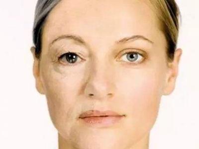 卸妝減少的肌膚問題,比你的護(hù)膚產(chǎn)品有用多了