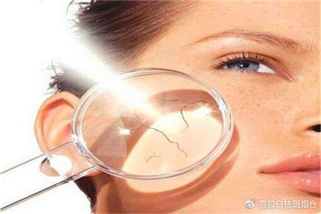 天然維生素的補充劑，生活中的必備佳品