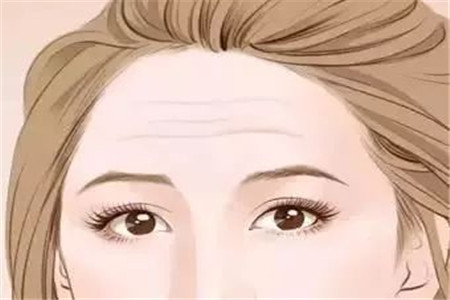 減少抬頭紋產生，你需要注意的三大步驟生活技巧