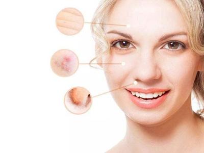 女性面部皮膚下垂怎么辦,四個方法延緩衰老