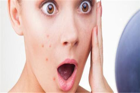 臉部各個(gè)地方長痘的原因和你的身體健康有關(guān)，如何解決有建議