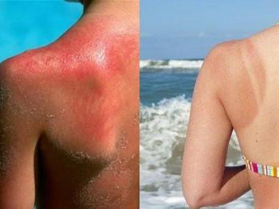 如何有效防曬,掌握兩個方法最重要