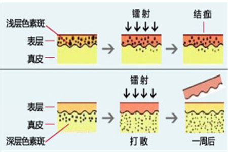 如何有效改善混合型肌膚不好的狀態，除了正確護膚步驟，還有哪些