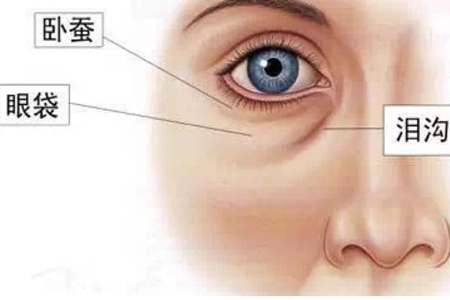 女性眼袋深是怎么形成的,消除眼袋的方法喚醒精神-易網<a href=http://www.jsjjzhkt.cn/ target=_blank class=infotextkey>健康養生</a>網 女性眼袋深是怎么形成的,消除眼袋的方法喚醒精神