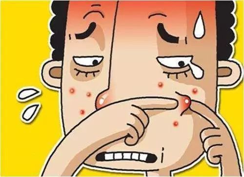 痤瘡不斷  收好這份戰(zhàn)“痘”書(shū)