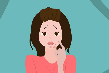 女性下巴長痘,原來是身體這里出問題,教你五招去除痘痘-易網健康<a href=http://www.jsjjzhkt.cn/jkys/ target=_blank class=infotextkey>養生</a>網 女性下巴長痘,原來是身體這里出問題,教你五招去除痘痘