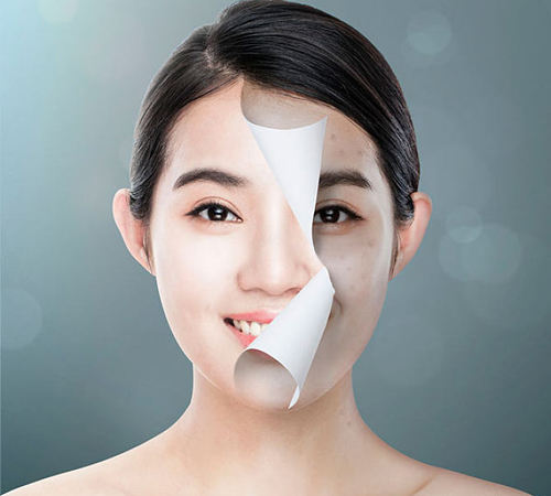 女人祛斑養顏的方法有哪些？4個方法讓肌膚凈白無暇