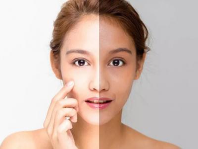 不可不知的祛斑小竅門 6個招趕走煩人斑點