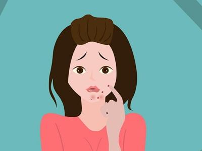 女性下巴長痘,原來是身體這里出問題,教你五招去除痘痘