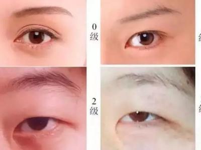 雙眼皮貼是在眼影之前還是之后？眼妝注意事項有哪些？