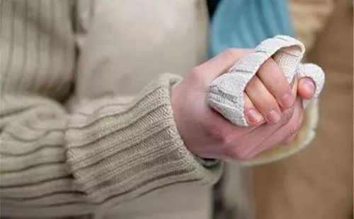 冬天天氣冷長凍瘡怎么辦?6個小妙招教給你-易網健康養生網 冬天天氣冷長凍瘡怎么辦?6個小妙招教給你