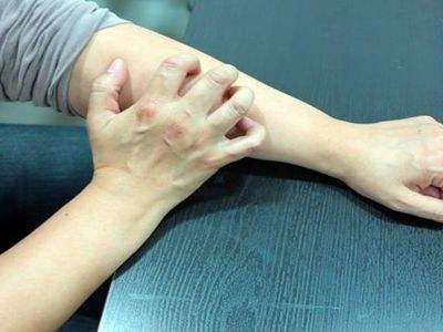 冬季皮膚瘙癢是怎么回事? 可能是6個因素在作怪