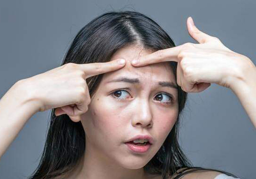 面部頻繁起痘是怎么回事？這4個(gè)原因要注意