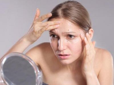 面部頻繁起痘是怎么回事?這4個原因要注意