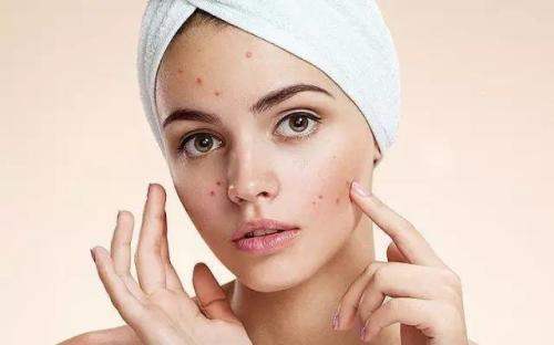 臉上長閉口怎么辦? 光做好清潔皮膚還不夠！