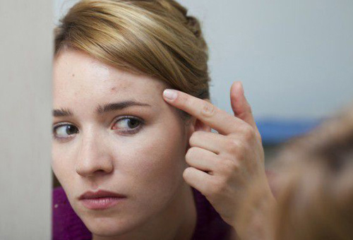 額頭長痘的原因及調(diào)理方法 杜絕痘痘橫行-易網(wǎng)健康養(yǎng)生網(wǎng) 額頭長痘的原因及調(diào)理方法 杜絕痘痘橫行