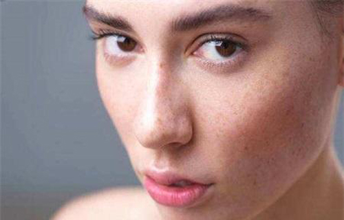 干性皮膚為什么容易長斑？色斑和皮膚干的聯系
