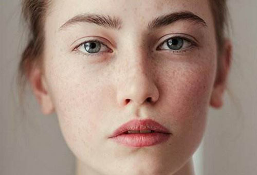 冬季敏感肌如何有效護理? 分享8個方法-易網<a href=http://www.jsjjzhkt.cn/ target=_blank class=infotextkey>健康養生</a>網 冬季敏感肌如何有效護理? 分享8個方法