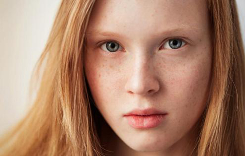 干性皮膚為什么容易長斑？色斑和皮膚干的聯系