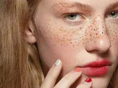 干性皮膚為什么容易長斑？色斑和皮膚干的聯系