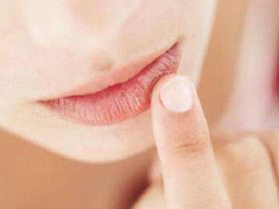 預防嘴唇干裂脫皮方法,冬季涂口紅做好唇部護理
