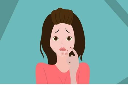 女生下巴長痘的原因，教你六個訣竅簡單祛痘