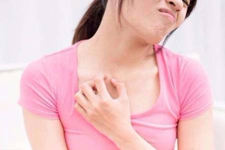 濕疹怎么治好得快？輕微濕疹和重度濕疹治療方式要區別對待