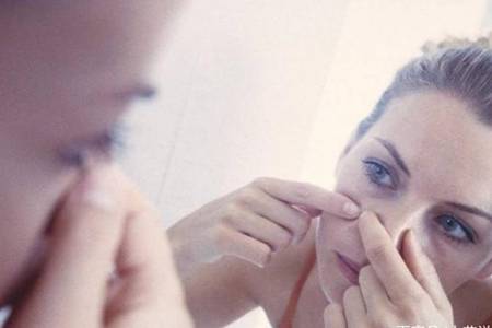 痘印最方便的去痘印方法，正確祛痘印還你好皮膚