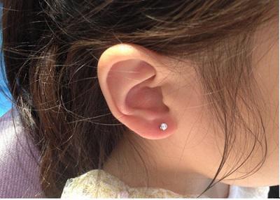 打耳洞需要注意什么?打耳洞發炎了怎么辦-易網健康<a href=http://www.jsjjzhkt.cn/jkys/ target=_blank class=infotextkey>養生</a>網 打耳洞需要注意什么?打耳洞發炎了怎么辦