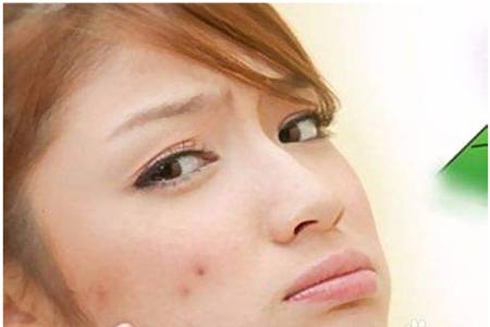 膿包型痤瘡的護理方法，教你六招修復皮膚